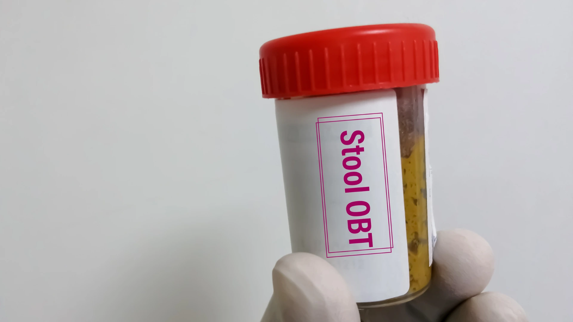 Fecal Occult Blood